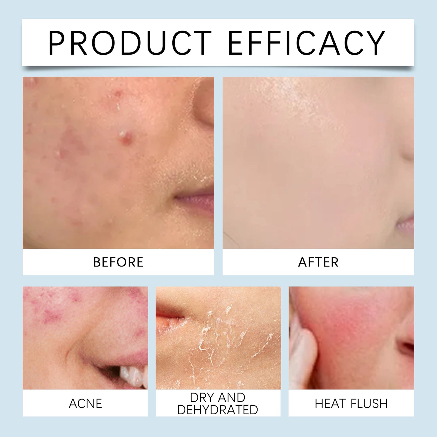 Hyaluronic Acid Face Serum, Radiant Facial Skin Improves Skin Pores And Hydrates