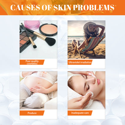 Papaya Whitening Freckle Cream Lightens Dark Spots On The Face, Brightens And Moisturizes The Skin Early And Late