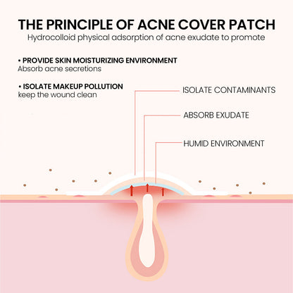 Pimples Patch, Mild Non-Irritant Lightening Pimples Spot Pimples Mark Covering Acne Pimples Patch