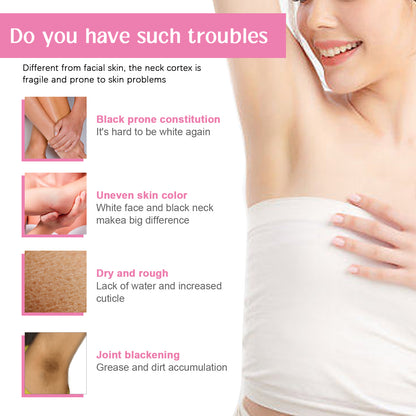 Underarm Whitening Essence Cream, Repair Acanthoderma Nigricans Tender And Smooth Skin Moisturizing Whitening Cream