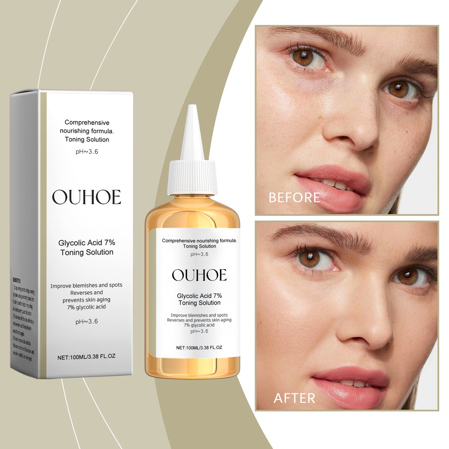 Glycolic Acid 7% Moisturizing Toner, Remove Acne, Improve Skin Condition And Rejuvenate Skin Toner Essence