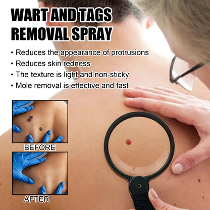Wart And Tags Removal Spray, Cleanse And Fade Body Moles Smooth Skin Repair Spray