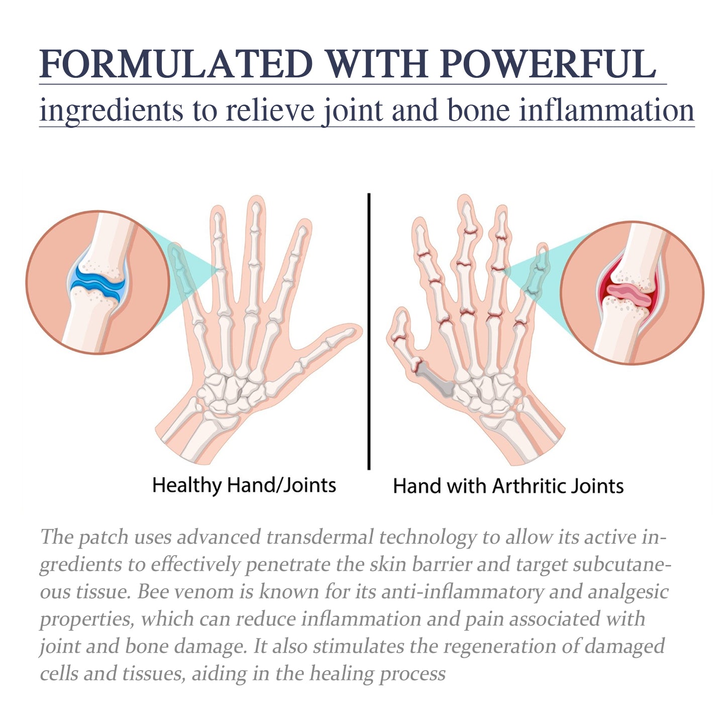 Bee Venom Joint Cream, Relieves Hands Legs Bones Knees Lumbar Spine Sedentary Joint Pain Body Care Cream
