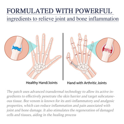 Bee Venom Joint Cream, Relieves Hands Legs Bones Knees Lumbar Spine Sedentary Joint Pain Body Care Cream