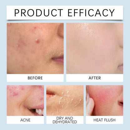 Hyaluronic Acid Face Serum, Radiant Facial Skin Improves Skin Pores And Hydrates