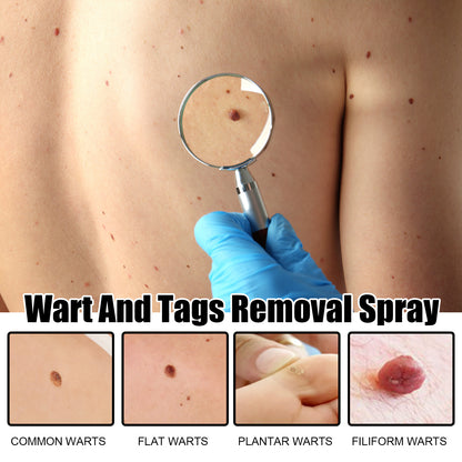Wart And Tags Removal Spray, Cleanse And Fade Body Moles Smooth Skin Repair Spray